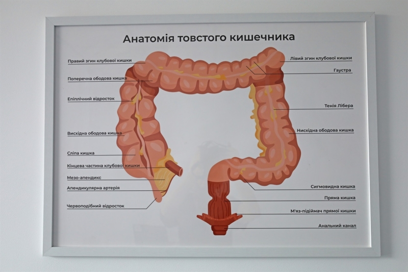 Лікар-проктолог у Жмеринці: «Цих проблем не треба соромитись, вони легко лікуються в «MEDSUN»